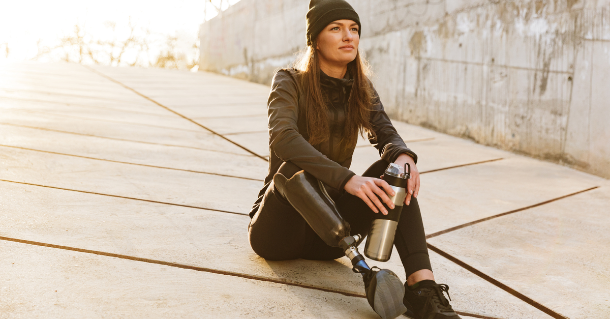 woman with prosthetic leg