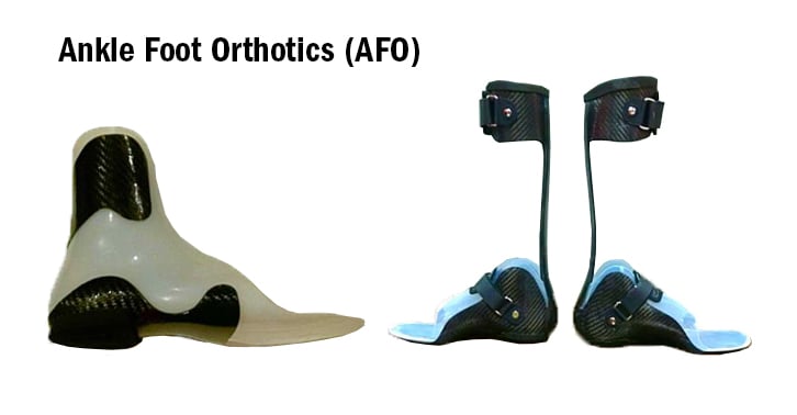 Ankle Foot Orthotics 