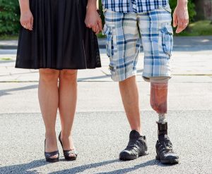 custom prosthesis 