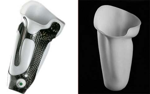 prosthetic limb socket