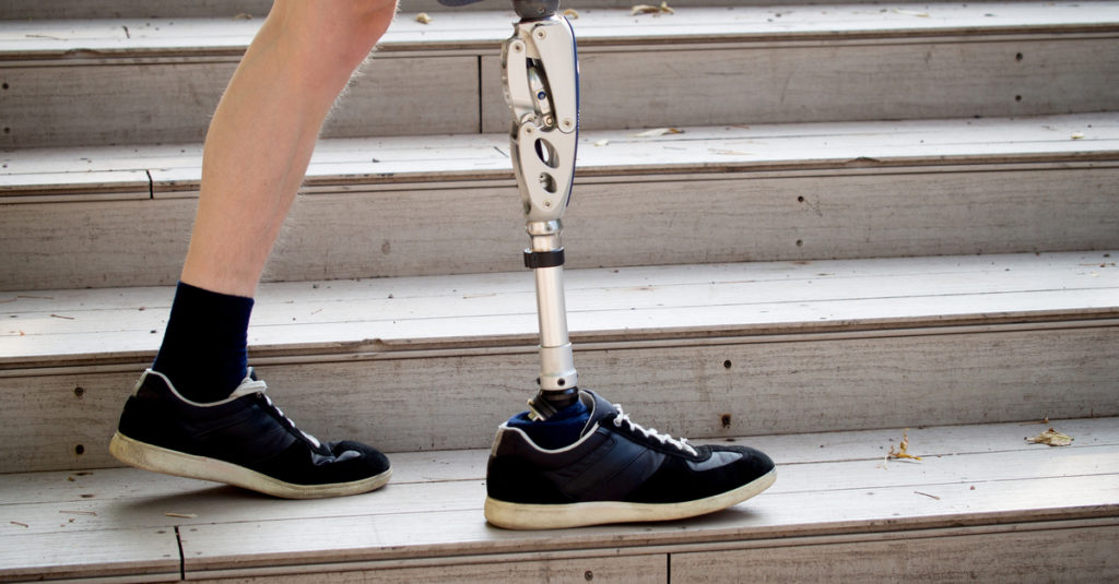 3 Things That Make the Best Personal Prosthesis