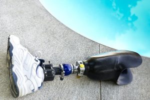 Prostheses Precautions