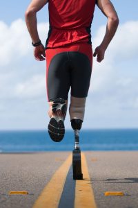 Tips for Trouble with Prosthetic Sockets