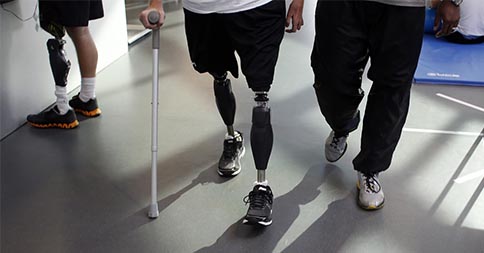 Why Gait Treatment Is Important