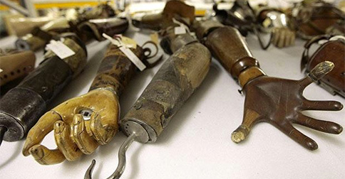 The History of Artificial Limb Prosthetic Devices