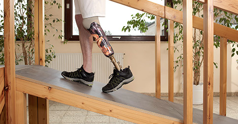 Recognize Your Possibilities with a Prosthesis