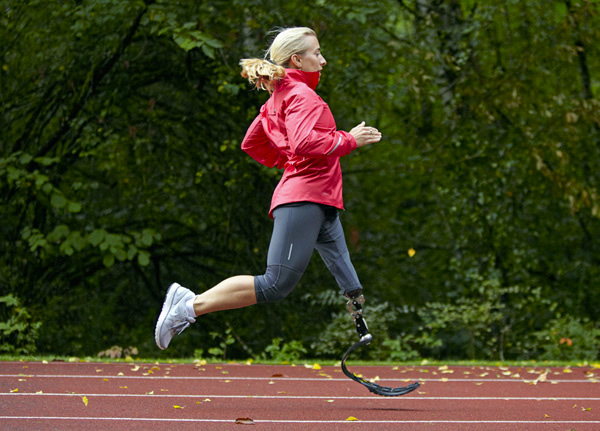 Running With a Prosthetic Leg