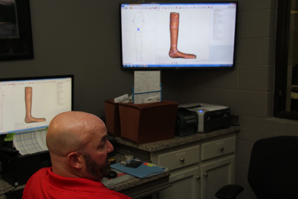 Our Three-Step Process for Building Better Prostheses and Orthoses
