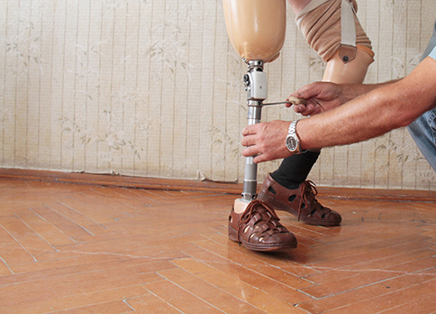 Learning to Walk with a Prosthesis